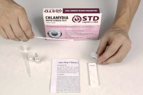 std home test kit chlamydia